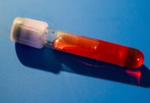 Можливий прорив: аналіз крові обіцяє точність у діагностиці хронічної втоми та тривалої інфекції