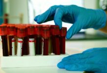 Au-delà des chiffres: Pourquoi le contexte est essentiel pour Comprendre vos Résultats de laboratoire