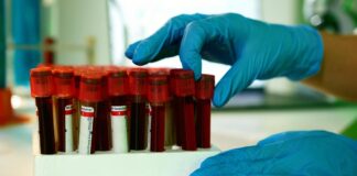 Více než čísla: proč je kontext klíčem k pochopení výsledků analýz