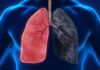 ¿Alto riesgo? El humo intenso de la marihuana y el vínculo con el cáncer