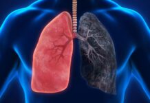 ¿Alto riesgo? El humo intenso de la marihuana y el vínculo con el cáncer
